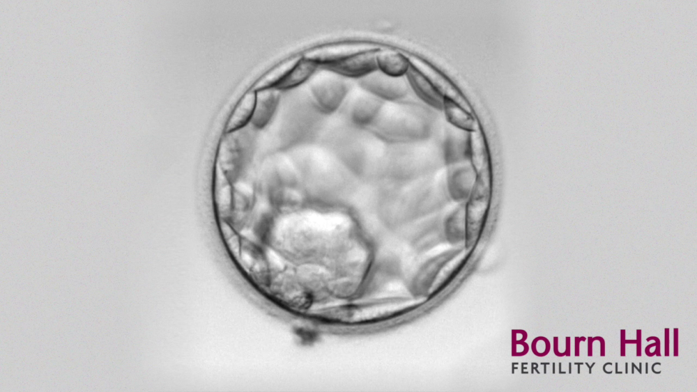 Early embryo development