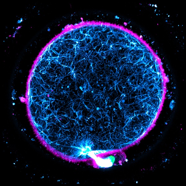 Human oocyte (anaphase)