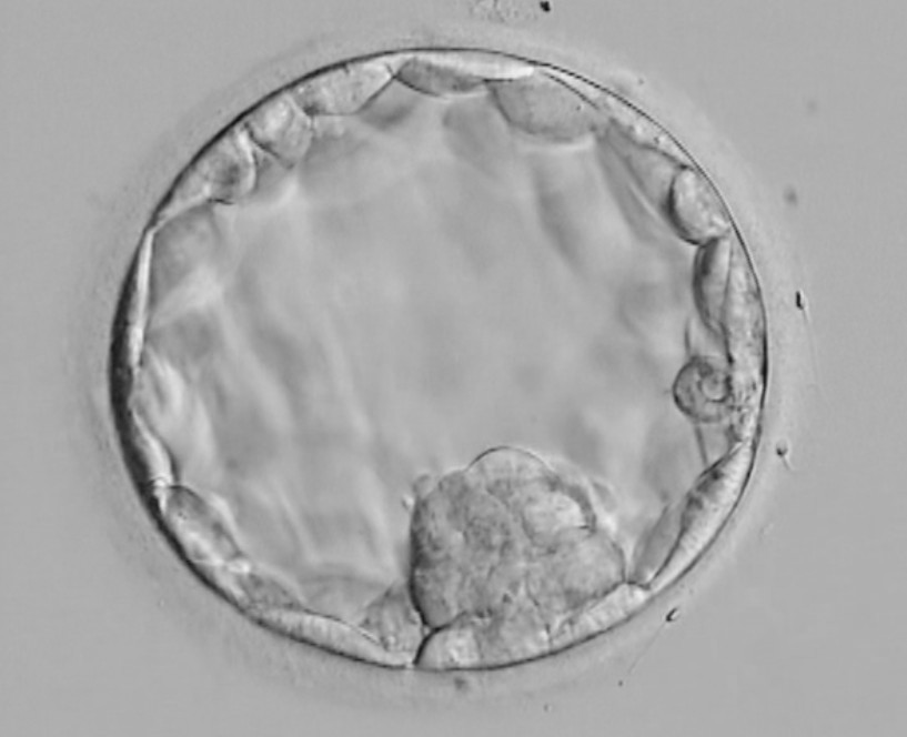 embryo grading blastocyst